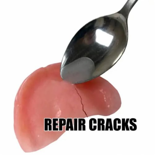 Instant Smile Complete Denture Repair Kit Perspective: top