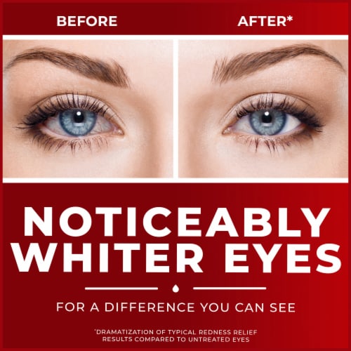Clear Eyes Max Redness Relief Eye Drops Perspective: top