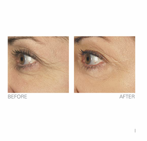 Stem Cell Therapy by BioLogic Solutions (1 oz.) Perspective: top