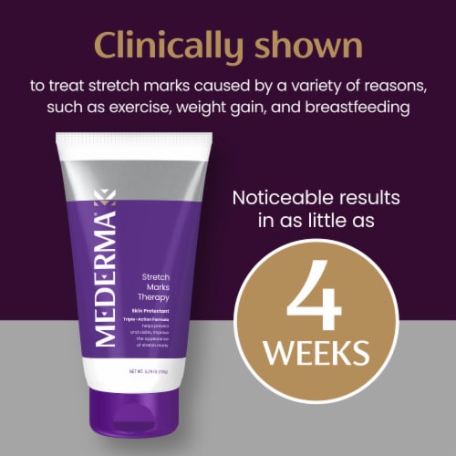 Mederma® Stretch Marks Therapy Skin Protectant Cream Perspective: top