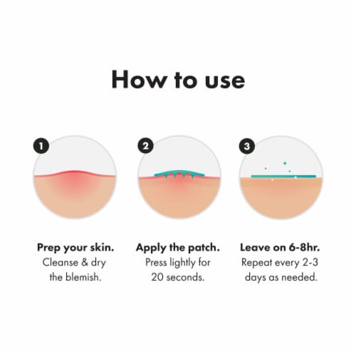 Hero Cosmetics Micropoint Mighty Patch For Blemishes Perspective: top