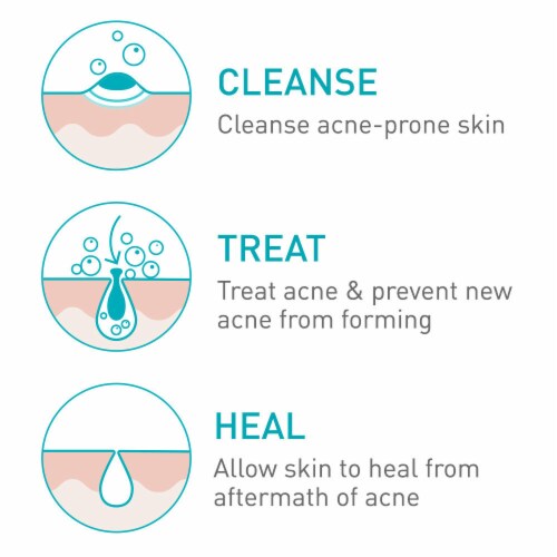 Cerave Acne Benzoyl Peroxide Foaming Cream Cleanser Perspective: top