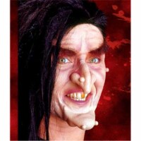 Stage Warts