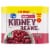 Kroger® Dark Red Kidney Beans Perspective: back
