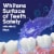 Kroger® Clean Mint Whitening Alcohol Free Mouth Rinse Perspective: back