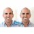Billy Bob Teeth Inc. Instant Smile® Complete Your Smile™ Tooth Replacement Kit Perspective: back
