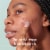 Hero Cosmetics Micropoint Mighty Patch For Blemishes Perspective: back