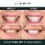 AutoBrush Whitening Kit and Oral Care System | Dental-Grade Blue Light System (Black) Perspective: back