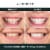 AutoBrush Whitening Kit and Oral Care System | Dental-Grade Blue Light System (Blue) Perspective: back