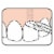 TEPE Bridge Implant Dental Floss - Thick, Flexible with Stiff Ends for Braces, 30 Pcs Perspective: bottom
