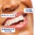 Colgate Sensitive Toothpaste Prevent and Repair Perspective: left