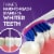 Oral-B Pro-Flex Stain Eraser Toothbrushes Perspective: left