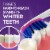 Oral-B 3D White Pro-Flex Stain Eraser Toothbrushes Perspective: left