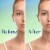 Differin Acne Face Wash with 10% Benzoyl Peroxide, (Pack of 2) Perspective: left