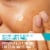 CeraVe Acne Control Gel, 2% Salicylic Acid Acne Treatment Clears Acne & Helps Prevent New Breakouts Perspective: left