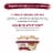 Purina Beneful Prepared Meals High Protein Wet Dog Food Beef Stew in Gravy Perspective: right