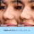 Biore The Original Deep Cleansing Pore Strips, Nose Strips for Blackhead Removal Perspective: right