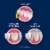 Fixodent Professional Plus Scope Ultimate Denture Adhesive Cream Perspective: right