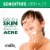 Stridex Sensitive with Aloe Soft Touch Pads Perspective: right