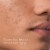 Neutrogena Rapid Clear Maximum Strength Acne Face Pads with 2% Salicylic Acid Acne Medication Perspective: right