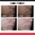 Neutrogena Stubborn Marks PM Treatment Perspective: right