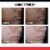 Neutrogena Stubborn Marks PM Treatment With Retinol Sa Perspective: right