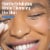 Cetaphil Extra Gentle Daily Face Scrub, Gently Exfoliates & Cleanses Perspective: right