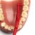 TEPE Interdental Brush Angle Cleaners - Dental Brushes Between Teeth 6 Pk, Red .5mm Perspective: top