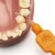 TEPE Interdental Brush Original Cleaners - Dental Brushes Between Teeth 25 Pk, Orange .45mm Perspective: top