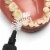 TEPE Interdental Brush Original Cleaners - Dental Brushes Between Teeth 25 Pk, Black 1.5mm Perspective: top