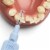 TEPE Interdental Brush Extra Soft Mixed Pack - Brushes Between Teeth 8 Pk, 0.45 to 1.1 MM Perspective: top